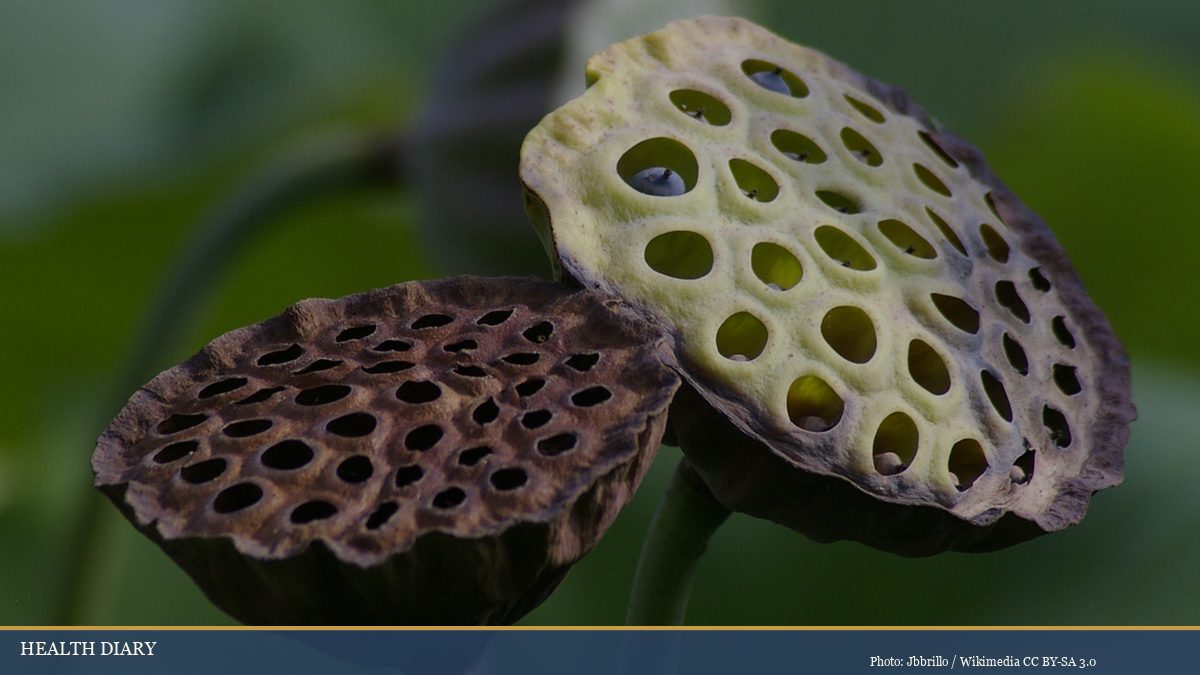 Fresh green and dried brown lotus seed pods showing the source of edible lotus seeds in Asian cuisine